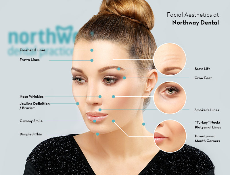 Botox Treatments in Maghull/Ormskirk