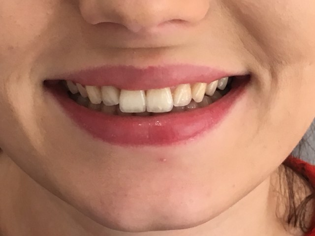 After
