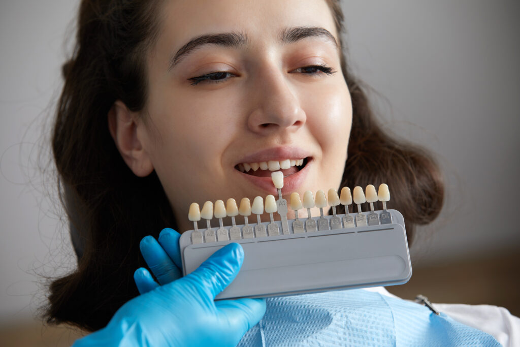 How to take care of your porcelain and composite veneers