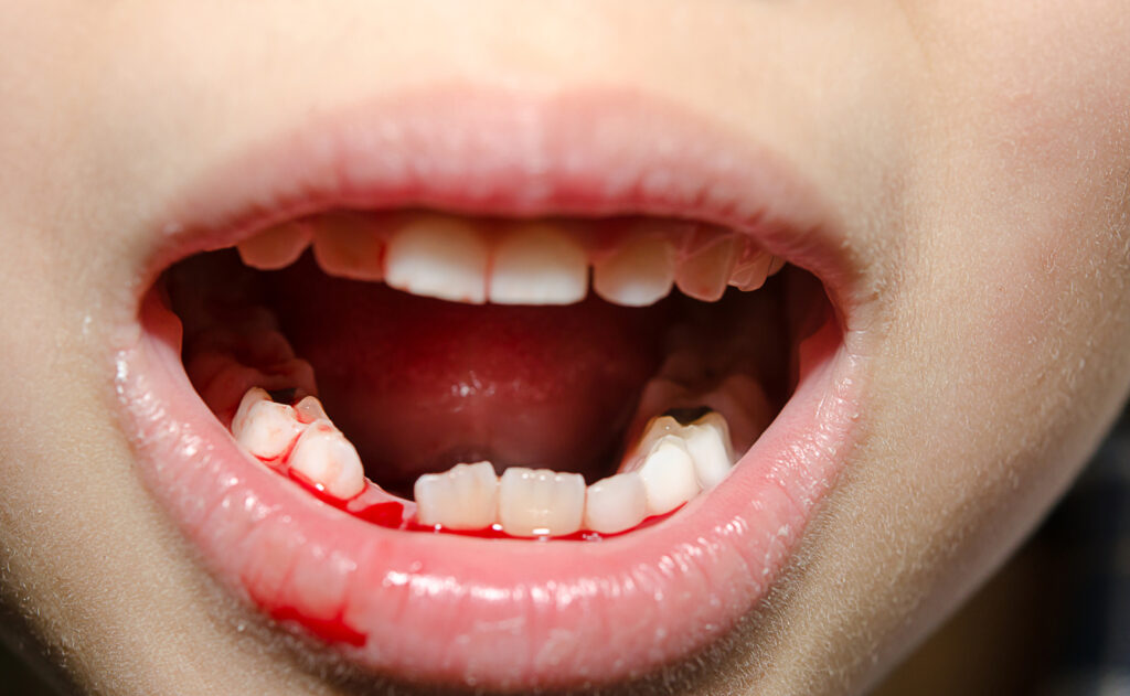 emergency dentist in Ormskirk